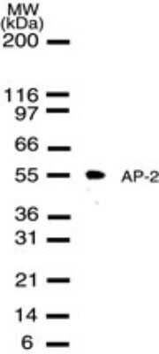 Dot Blot: AP2 alpha Antibody [NB100-56332] - Analysis of AP-2 in MCF-7 cell lysate with this antibody. A protein band of an approximate molecular weight of 55 kDa is detected.