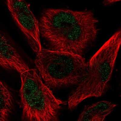 Immunocytochemistry/Immunofluorescence: AP2 alpha Antibody [NBP2-38809] - Staining of human cell line U-251 MG shows localization to nucleoplasm. Antibody staining is shown in green.