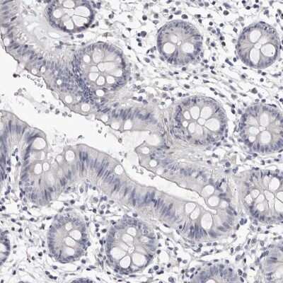 Immunohistochemistry-Paraffin: AP2 alpha Antibody [NBP1-90143] - Staining of human colon shows low expression as expected.