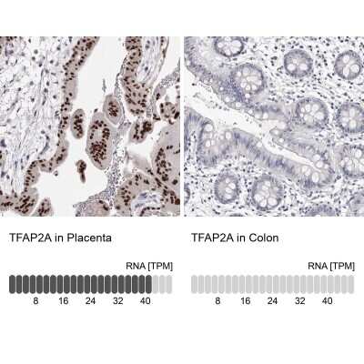 Immunohistochemistry-Paraffin: AP2 alpha Antibody [NBP1-90143] - Staining in human placenta and colon tissues using anti-TFAP2A antibody. Corresponding TFAP2A RNA-seq data are presented for the same tissues.