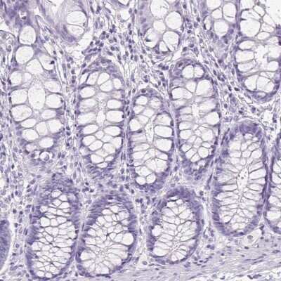 Immunohistochemistry-Paraffin: AP2 alpha Antibody [NBP2-38809] - Staining of human colon shows low expression as expected.