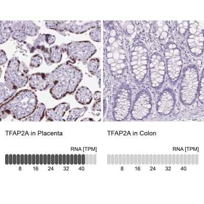 Immunohistochemistry-Paraffin: AP2 alpha Antibody [NBP2-38809] - Staining in human placenta and colon tissues using anti-TFAP2A antibody. Corresponding TFAP2A RNA-seq data are presented for the same tissues.