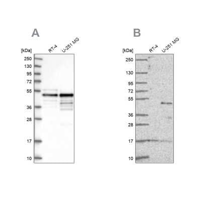 <b>Independent Antibodies Validation and Orthogonal Strategies Validation.</b>Western Blot: AP2 alpha Antibody [NBP1-90143] - Analysis using Anti-TFAP2A antibody NBP1-90143 (A) shows similar pattern to independent antibody NBP2-38809 (B).