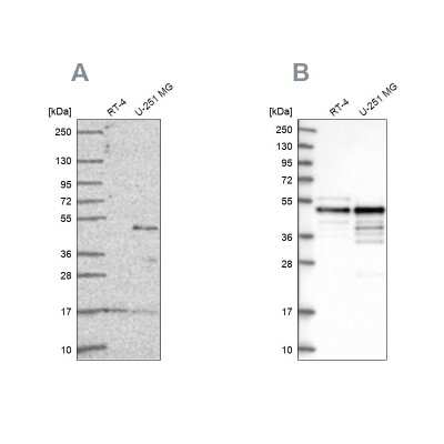 <b>Independent Antibodies Validation and Orthogonal Strategies Validation.</b>Western Blot: AP2 alpha Antibody [NBP2-38809] - Analysis using Anti-TFAP2A antibody NBP2-38809 (A) shows similar pattern to independent antibody NBP1-90143 (B).