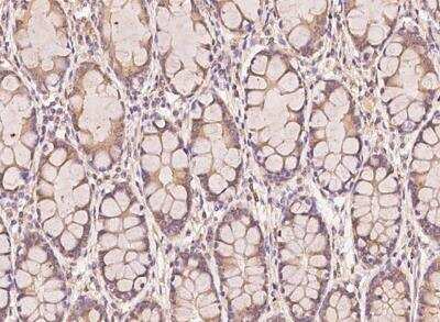Immunohistochemistry-Paraffin: AP2A2 Antibody [NBP3-12692] - Staining of human AP2A2 in human rectum with rabbit polyclonal antibody at 1:100 dilution.