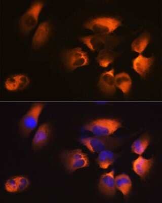 Immunocytochemistry/Immunofluorescence: AP2M1 Antibody (10J8D1) [NBP3-15341] - Immunofluorescence analysis of U-251MG cells using AP2M1 Rabbit mAb (NBP3-15341) at dilution of 1:100 (40x lens). Blue: DAPI for nuclear staining.