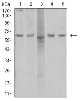 Western Blot: AP2M1 Antibody (4F1B2) [NBP2-61866] - Analysis using AP2M1 mouse mAb against COS7 (1), SK-Br-3 (2), MCF-7 (3), T47D (4), and HEK293 (5) cell lysate.