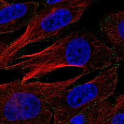 Immunocytochemistry/Immunofluorescence: AP2M1 Antibody [NBP2-55860] - Staining of human cell line U-251 MG shows localization to plasma membrane.