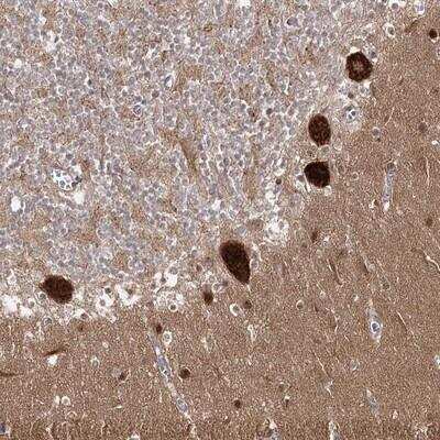 Immunohistochemistry: AP2M1 Antibody [NBP1-89055] - Staining of human cerebellum shows strong cytoplasmic positivity in purkinje cells.