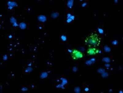Immunocytochemistry/Immunofluorescence: AP2M1 Antibody (OTI1E9) - Azide and BSA Free [NBP2-70417] - Staining of COS7 cells transiently transfected by pCMV6-ENTRY AP2M1.