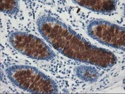 Immunohistochemistry: AP2M1 Antibody (OTI1E9) - Azide and BSA Free [NBP2-70417] - Staining of paraffin-embedded Human colon tissue using anti-AP2M1 mouse monoclonal antibody.