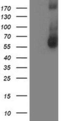 Western Blot: AP2M1 Antibody (OTI1E9) - Azide and BSA Free [NBP2-70417] - HEK293T cells were transfected with the pCMV6-ENTRY control (Left lane) or pCMV6-ENTRY AP2M1 (Right lane) cDNA for 48 hrs and lysed. Equivalent amounts of cell lysates (5 ug per lane) were separated by SDS-PAGE and immunoblotted with anti-AP2M1.