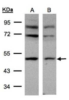 Western Blot: AP2M1 Antibody [NBP1-32272] - Sample(30 ug of whole cell lysate)A:293T B:HeLa S3 10% SDS PAGE, antibody diluted at 1:500.