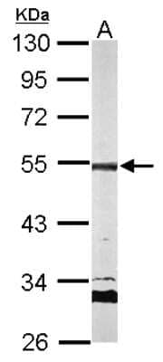 Western Blot: AP2M1 Antibody [NBP2-15418] - Sample (50 ug of whole cell lysate) A: mouse brain 10% SDS PAGE, antibody diluted at 1:500.