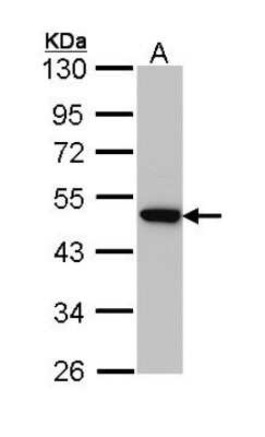 Western Blot: AP2M1 Antibody [NBP2-15418] - Sample (30 ug of whole cell lysate) A: Hep G2 10% SDS PAGE; antibody diluted at 1:1000.