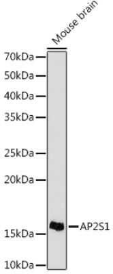 Western Blot: AP2S1 Antibody (4G1G1) [NBP3-16796] - Western blot analysis of extracts of Mouse brain cells, using AP2S1 antibody (NBP3-16796) at 1:1000 dilution. Secondary antibody: HRP Goat Anti-Rabbit IgG (H+L) at 1:10000 dilution. Lysates/proteins: 25ug per lane. Blocking buffer: 3% nonfat dry milk in TBST. Detection: ECL Basic Kit. Exposure time: 30s.