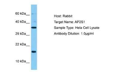 Western Blot: AP2S1 Antibody [NBP2-83937] - Host: Rabbit. Target Name: AP2S1. Sample Tissue: Human Hela Whole Cell lysates. Antibody Dilution: 1ug/ml