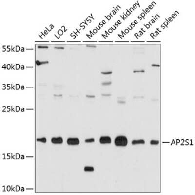 Western Blot: AP2S1 Antibody [NBP2-92072] - Analysis of extracts of various cell lines, using AP2S1 at 1:3000 dilution.Secondary antibody: HRP Goat Anti-Rabbit IgG (H+L) at 1:10000 dilution.Lysates/proteins: 25ug per lane.Blocking buffer: 3% nonfat dry milk in TBST.Detection: ECL Basic Kit .Exposure time: 20s.