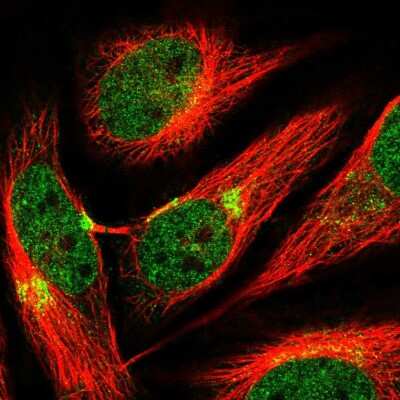 Immunocytochemistry/Immunofluorescence: AP3B1 Antibody [NBP2-55681] - Staining of human cell line HeLa shows localization to nucleoplasm & the Golgi apparatus.