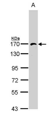 Western Blot: AP3B1 Antibody [NBP1-33723] - Sample (30 ug of whole cell lysate) A: Hep G2 7. 5% SDS PAGE; antibody diluted at 1:1000.