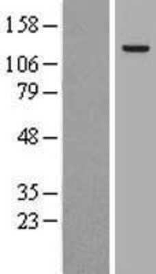 Western Blot: AP3B1 Overexpression Lysate (Adult Normal) [NBL1-07583] Left-Empty vector transfected control cell lysate (HEK293 cell lysate); Right -Over-expression Lysate for AP3B1.