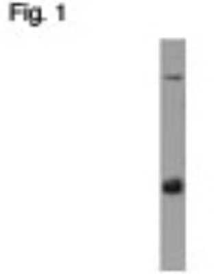 Western Blot: AP3B2 Antibody [NB100-74370] - Figure 1 illustrates Western blot detection of beta-NAP at ~125 kDa using NB100-74370. A ~50 kDa band is also seen in rat and mouse brain tissue, representing the medium chain homolog (p47A) of AP3.