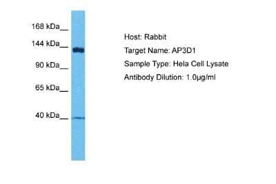 Western Blot: AP3D1 Antibody [NBP2-84438] - Host: Rabbit. Target Name: AP3D1. Sample Tissue: Human Hela Whole Cell lysates. Antibody Dilution: 1ug/ml