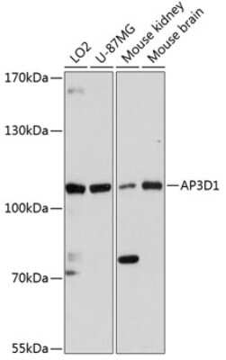 Western Blot: AP3D1 Antibody [NBP2-92046] - Analysis of extracts of various cell lines, using AP3D1 at 1:3000 dilution.Secondary antibody: HRP Goat Anti-Rabbit IgG (H+L) at 1:10000 dilution.Lysates/proteins: 25ug per lane.Blocking buffer: 3% nonfat dry milk in TBST.Detection: ECL Basic Kit .Exposure time: 90s.