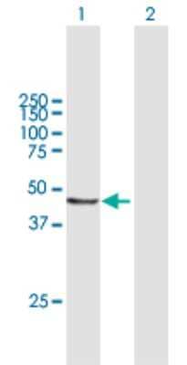 Western Blot: AP3M2 Antibody [H00010947-B01P] - Analysis of AP3M2 expression in transfected 293T cell line by AP3M2 polyclonal antibody.  Lane 1: AP3M2 transfected lysate(45.98 KDa). Lane 2: Non-transfected lysate.