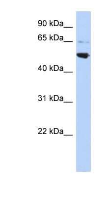 Western Blot: AP3M2 Antibody [NBP1-56624] - HepG2 cell lysate, concentration 0.2-1 ug/ml.