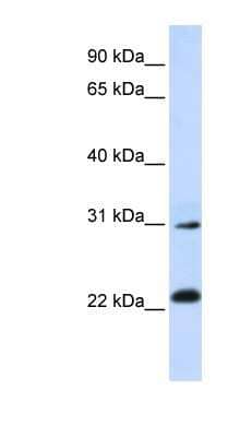 Western Blot: AP3S1 Antibody [NBP1-55449] - Jurkat cell lysate, concentration 0.2-1 ug/ml.