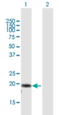 Western Blot: AP3S2 Antibody [H00010239-B01P] - Analysis of AP3S2 expression in transfected 293T cell line by AP3S2 polyclonal antibody.  Lane 1: AP3S2 transfected lysate(21.23 KDa). Lane 2: Non-transfected lysate.