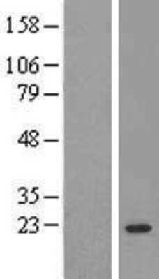 Western Blot: AP3S2 Overexpression Lysate (Adult Normal) [NBL1-07587] Left-Empty vector transfected control cell lysate (HEK293 cell lysate); Right -Over-expression Lysate for AP3S2.