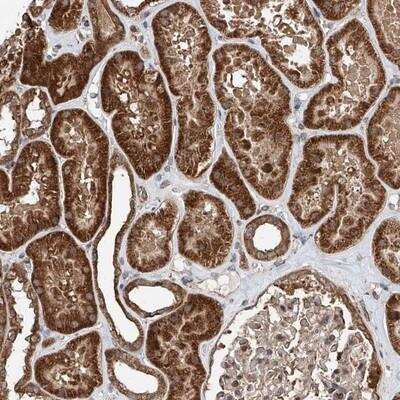 Immunohistochemistry: AP4B1 Antibody [NBP1-88657] - Staining of human kidney shows strong cytoplasmic positivity with granular pattern in renal tubules.