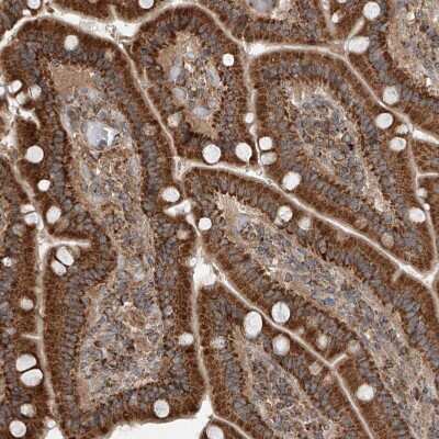 Immunohistochemistry-Paraffin: AP4B1 Antibody [NBP1-88657] - Staining of human Duodenum shows moderate granular cytoplasmic positivity in glandular cells.