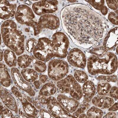 Immunohistochemistry-Paraffin: AP4B1 Antibody [NBP1-88657] - Staining of human Kidney shows strong granular cytoplasmic positivity in cells in tubules.