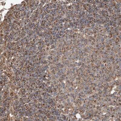 Immunohistochemistry-Paraffin: AP4B1 Antibody [NBP1-88657] - Staining of human Lymph node shows strong granular cytoplasmic positivity in germinal and non-germinal center cells.