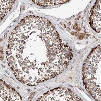 Immunohistochemistry-Paraffin: AP4B1 Antibody [NBP1-88657] - Staining of human Testis shows strong granular cytoplasmic positivity in cells in seminiferous ducts and leydig cells.