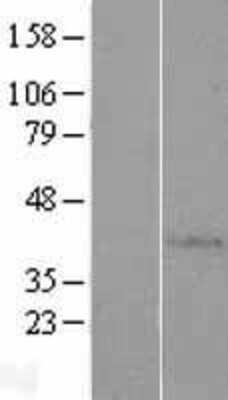 Western Blot: AP4S1 Overexpression Lysate (Adult Normal) [NBP2-07535] Left-Empty vector transfected control cell lysate (HEK293 cell lysate); Right -Over-expression Lysate for AP4S1.