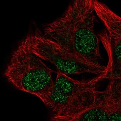 Immunocytochemistry/Immunofluorescence: AP5B1 Antibody [NBP2-49460] - Immunofluorescent staining of human cell line SK-MEL-30 shows localization to nucleoplasm.