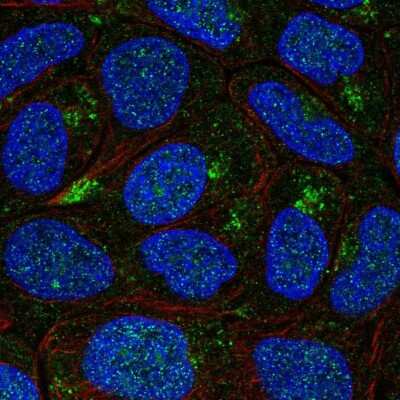 Immunocytochemistry/Immunofluorescence: AP5B1 Antibody [NBP2-49531] - Immunofluorescent staining of human cell line RT4 shows localization to nucleus & the Golgi apparatus.