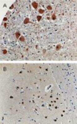Immunohistochemistry-Paraffin: APAF-1 Antibody [NB100-56072] - Formalin-fixed, paraffin-embedded human brain tissue tissue sections stained for Apaf -1 espression using this antibody at 1:2000. A) Brain stem. B) Cortex. Hematoxylin-eosin counterstain.