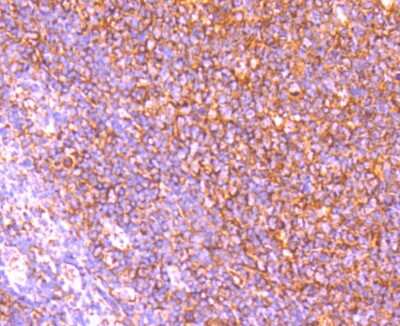 Immunohistochemistry-Paraffin: APAF-1 Antibody (SY22-02) [NBP2-67422] - Analysis of paraffin-embedded human tonsil tissue using anti-Apaf-1 antibody. Counter stained with hematoxylin.
