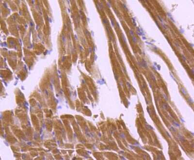 Immunohistochemistry-Paraffin: APAF-1 Antibody (SY22-02) [NBP2-67422] - Analysis of paraffin-embedded mouse heart tissue using anti-Apaf-1 antibody. Counter stained with hematoxylin.