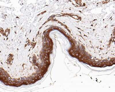 Immunohistochemistry-Paraffin: APAF-1 Antibody (SY22-02) [NBP2-67422] - Analysis of paraffin-embedded Human skin tissue untreaed and treated with -PPase with Rabbit anti-Apaf-1 antibody washed with ddH2O and PBS, and then probed with the primary antibody  at 1/200 dilution for 1 hour at room temperature. The detection was performed using an HRP conjugated compact polymer system. DAB was used as the chromogen. Tissues were counterstained with hematoxylin and mounted with DPX.