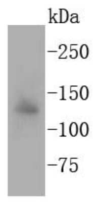Western Blot: APAF-1 Antibody (SY22-02) [NBP2-67422] - Analysis of Apaf-1 on HUVEC cell lysates using anti-Apaf-1 antibody at 1/1,000 dilution.