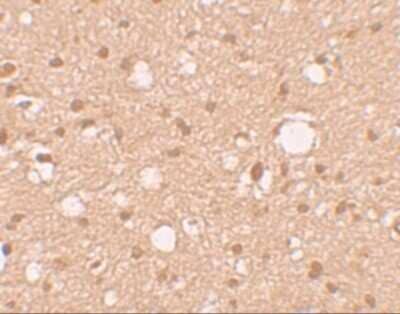 Immunohistochemistry: APBA2 Antibody [NBP2-41127] - Immunohistochemistry of APBA2 in human brain tissue with APBA2 antibody at 10 ug/mL.