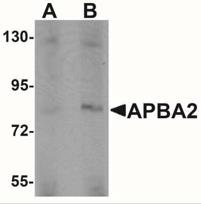 Western Blot: APBA2 Antibody [NBP2-41127] - Western blot analysis of APBA2 in human brain tissue lysate with APBA2 antibody at (A) 1 and (B) 2 ug/mL.