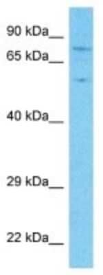 Western Blot: APBA2 Antibody [NBP3-10789] - Western blot analysis of APBA2 in 721_B Whole Cell lysates. Antibody dilution at 1.0ug/ml