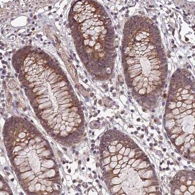 Immunohistochemistry-Paraffin: APBA3/Mint-3 Antibody [NBP1-92117] - Staining of human colon shows moderate cytoplasmic positivity in glandular cells.